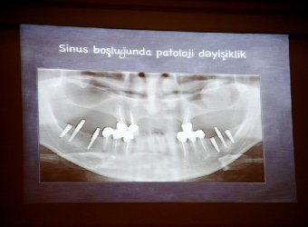 sel_8100.jpg